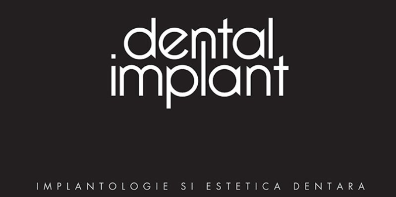 Dental Implant - Clinica stomatologica