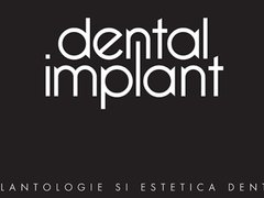 Dental Implant - Clinica stomatologica