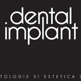 Dental Implant - Clinica stomatologica