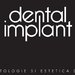 Dental Implant - Clinica stomatologica